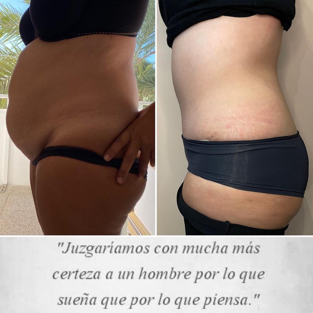 Before and After Result